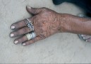 Beautiful rings
