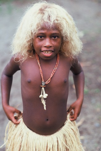[Image: Natural_blonde_is_common_It_is_not_malnu...n_big.jpeg]